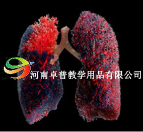 铸型标本（肺的管道（动脉和静脉))