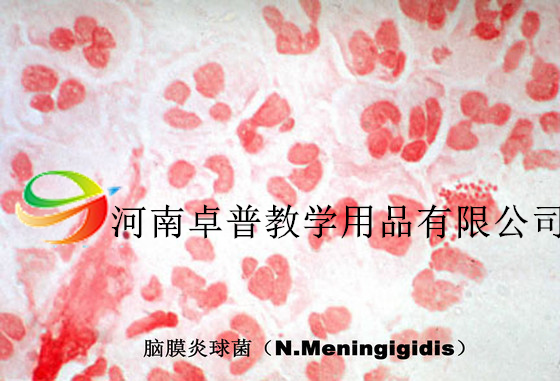 微生物切片（脑膜炎球菌）